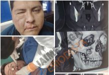 Un fracturado, gases, balas de goma y un DT argentino entre los 17 expulsados: el video de la batalla campal en Bolivia