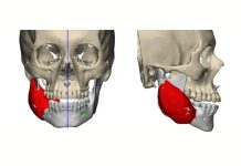 El Hospital Pirovano hizo la primera cirugía con realidad aumentada en el sistema público porteño