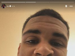 La impactante imagen del futbolista que sufrió un brutal choque con el arquero rival en la Serie A y se desmayó