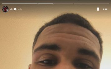 La impactante imagen del futbolista que sufrió un brutal choque con el arquero rival en la Serie A y se desmayó