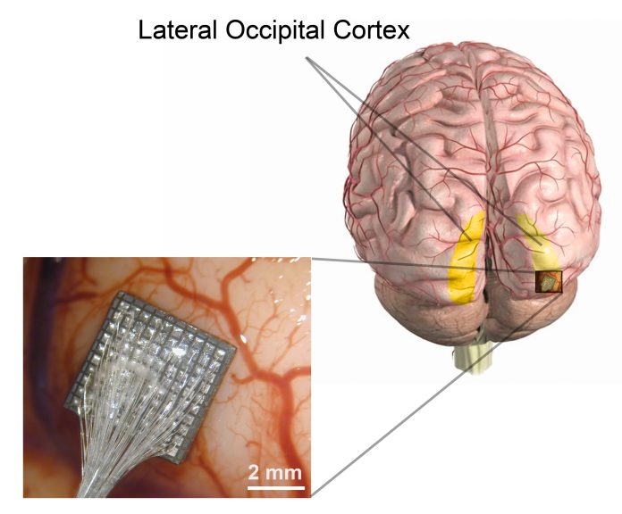 Logran que una persona ciega recupere parte de la visión con microestimulación cerebral