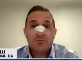 Habló el diputado fracturado de un cabezazo en Tucumán: “Quizás me tengan que volver a operar”