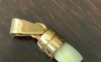 La historia detrás del mito del colgante del Chino Maidana con el diente de Mayweather: el derechazo inolvidable que marcó la épica revancha