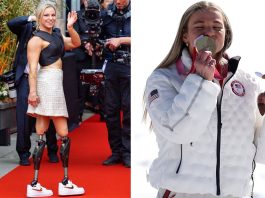 Sufrió malformaciones por una explosión nuclear, pero un gesto cambió su vida y se transformó en la figura de los Juegos Paralímpicos de Invierno