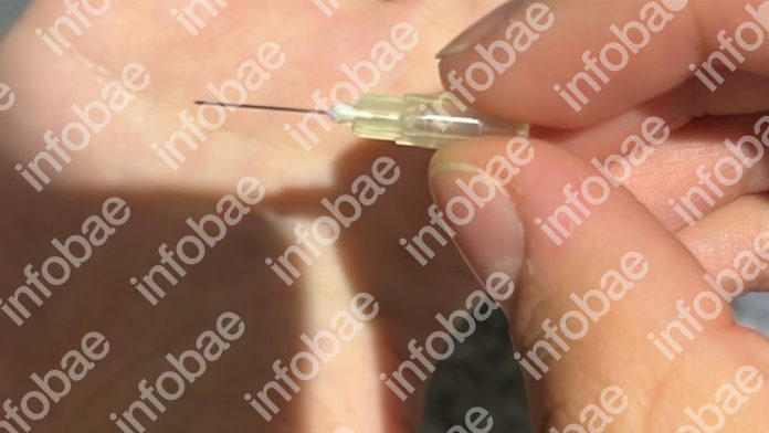 Imputaron a “Tati” Leclercq por robo de anestesia: las agujas que encontraron en el laundry de su edificio