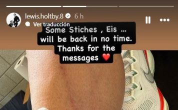 La impresionante lesión en el fútbol europeo que abrió el debate sobre el uso de las canilleras