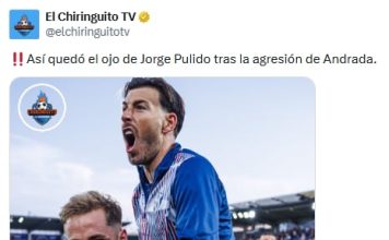 Ojo morado y hielo: las imágenes de las secuelas que sufrió el futbolista español agredido por Esteban Andrada