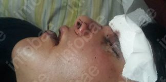 “Se ahogaba con su sangre”, el crudo relato de la novia del joven que denunció una agresión en un boliche de San Telmo