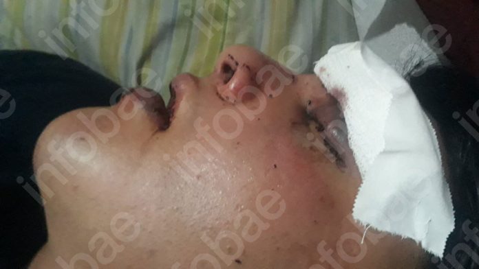 “Se ahogaba con su sangre”, el crudo relato de la novia del joven que denunció una agresión en un boliche de San Telmo