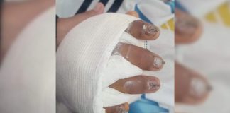 “Tiene el 95% de la mano destruida”: la mamá de un alumno accidentado en una escuela de Jujuy denunció abandono