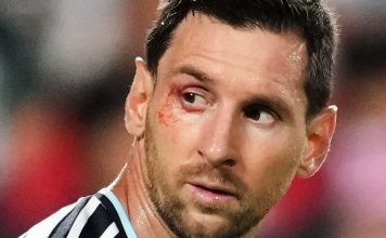 El corte en el ojo que sufrió Lionel Messi durante el duelo entre Argentina y Suiza del Mundial 2026