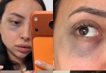 La novia de un ex futbolista de Boca lo acusó por violencia de género