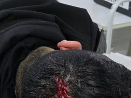 Escaparon de un control, se escondieron en una casa y agredieron a la Policía: hay tres detenidos