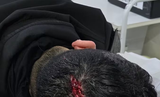 Escaparon de un control, se escondieron en una casa y agredieron a la Policía: hay tres detenidos