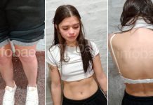 Excoriaciones y eritema: qué dijo el médico que examinó a la joven que asesinó a su novio tras una discusión en Chaco