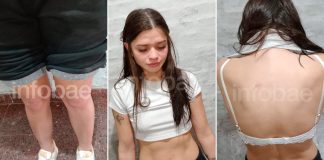 El informe forense sobre las lesiones de la joven acusada de matar a su novio en Chaco y la “amnesia lacunar” que plantea su defensa