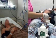 Denunciaron una brutal golpiza por homofobia contra una pareja en Tucumán: uno de ellos está en terapia intensiva