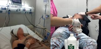 Denunciaron una brutal golpiza por homofobia contra una pareja en Tucumán: uno de ellos está en terapia intensiva